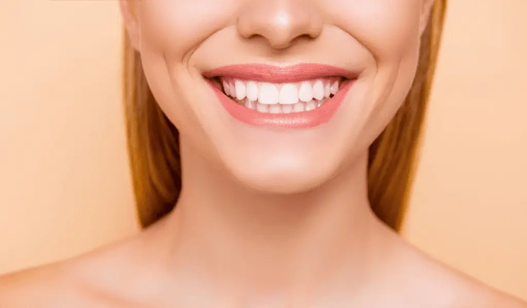 Donna con sorriso brillante per illustrare rimedi naturali per lo sbiancamento dentale