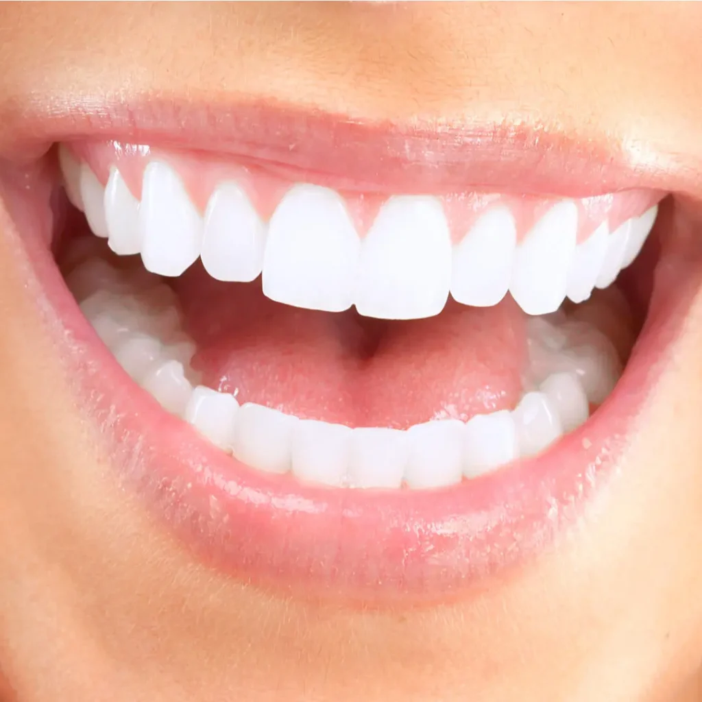 Sorriso che mostra denti sani, focus sulle differenze tra bruxismo notturno e diurno