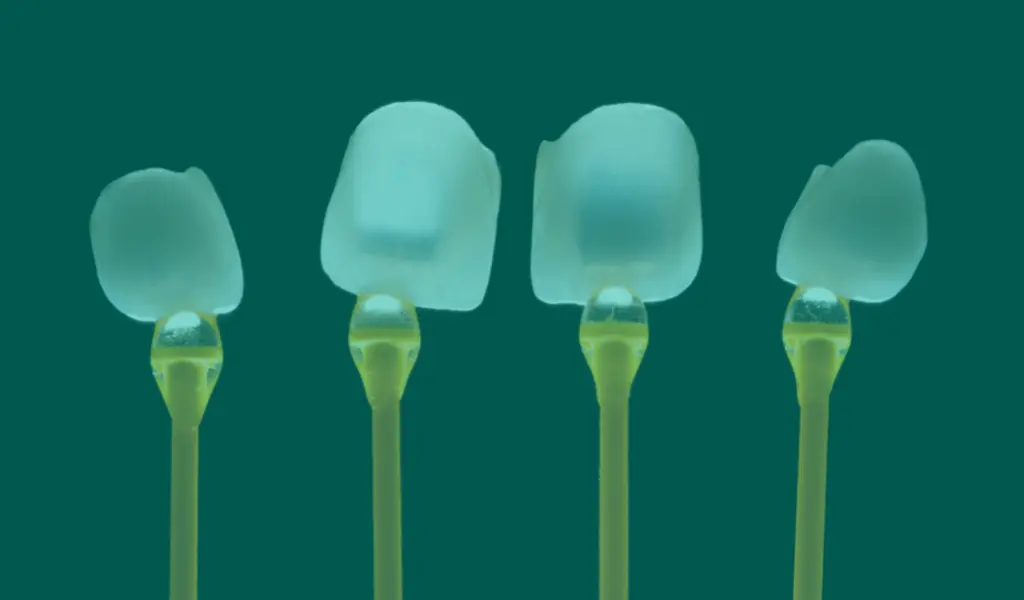 Faccette dentali