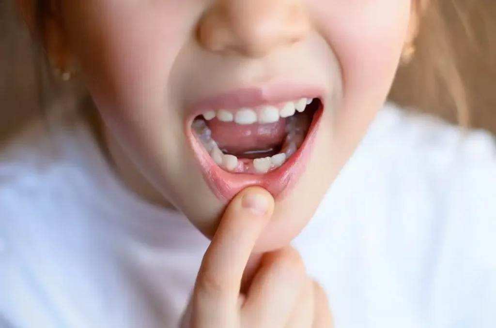 denti da latte